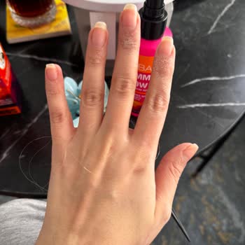 Urban Care Summer Glow Lightener Caused Severe Hand Irritation