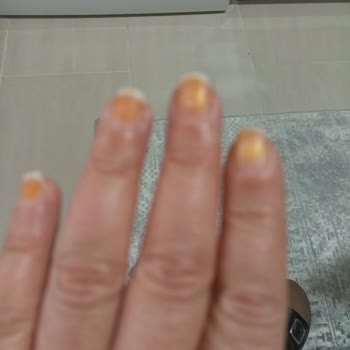 Flormar Oje Kullanımı Sonrası Kalıcı Turuncu Leke Sorunu