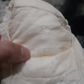 Sleepy Bebek Bezinde Siyah Tanecik Şoku