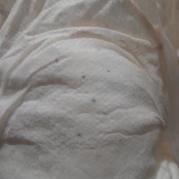 Sleepy Bebek Bezinde Siyah Tanecik Şoku