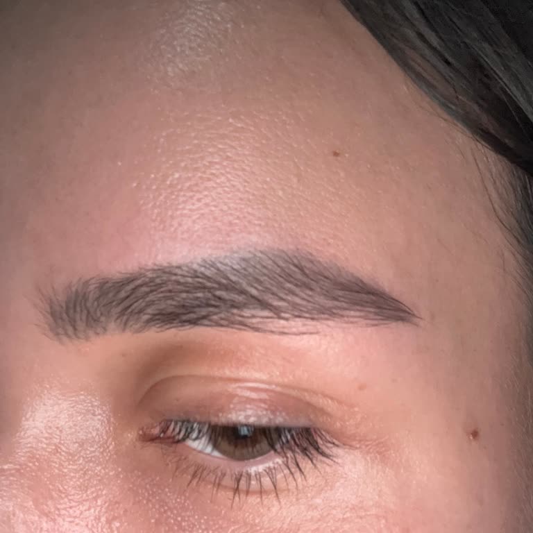 Kalıcı Kaş İşleminde Beklenmeyen Sonuçlar Ve Yüksek Maliyet