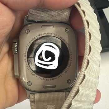 Apple Watch Ultra'da Beklenmedik Cilt Problemi