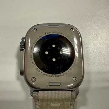 Apple Watch Ultra'da Beklenmedik Cilt Problemi