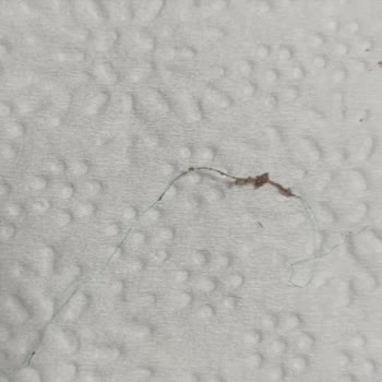 Victoria Pastanesi (Dikmen) Çikolatalı Pastada Şok Edici Buluntu