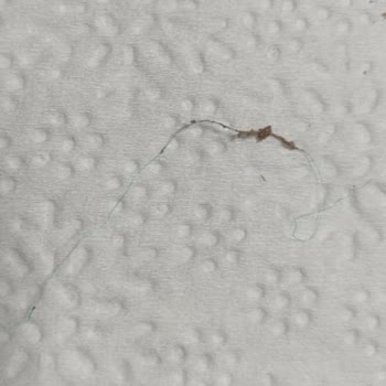 Victoria Pastanesi (Dikmen) Çikolatalı Pastada Şok Edici Buluntu