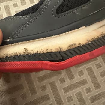 Skechers Ayakkabıda 5 Ayda Büyük Hayal Kırıklığı