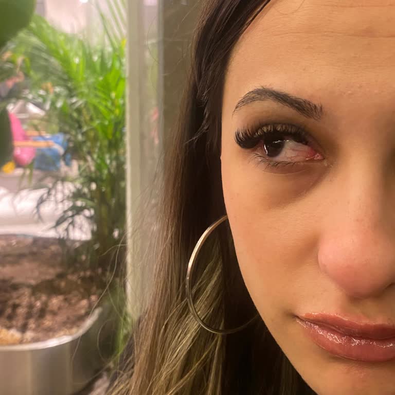 Aymira Koçaklı Yaşam Merkezi Göz Sağlığını Tehlikeye Atan İpek Kirpik Uygulaması