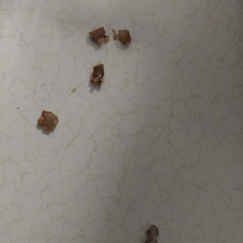 Çiğ Köfte İçindeki Ceviz Kabuğu Dişimi Kırdı!