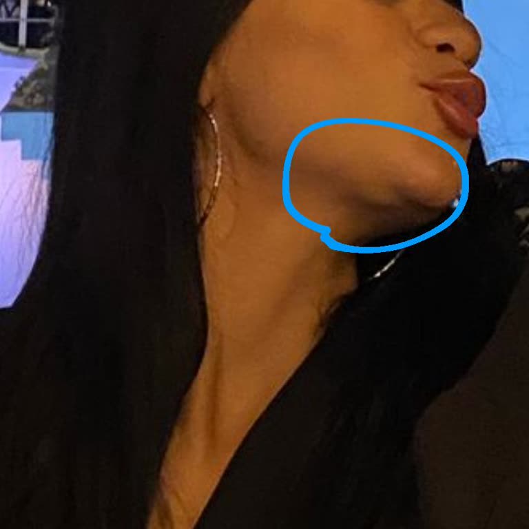 Estetik İşlemde Yaşanan Büyük Sorun