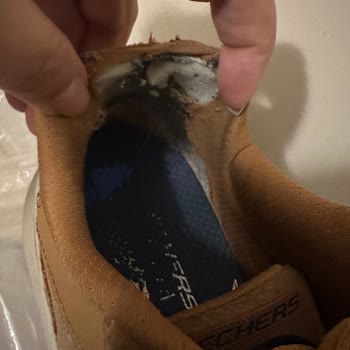 Sketchers Ayakkabıda Topuk Problemi Ve Yetersiz Müşteri Hizmeti