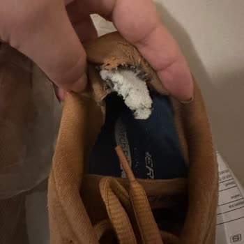 Sketchers Ayakkabıda Topuk Problemi Ve Yetersiz Müşteri Hizmeti