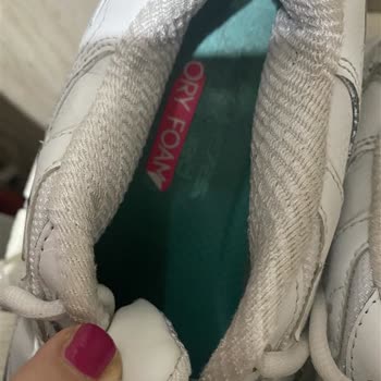 Skechers Ayakkabıda Beklenmedik Hızlı Deformasyon