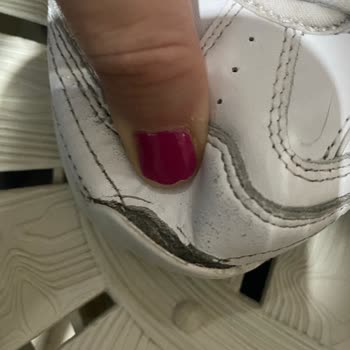 Skechers Ayakkabıda Beklenmedik Hızlı Deformasyon