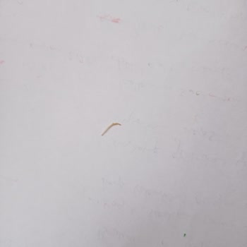 Cipsin İçinden Çıkan Şok Edici Sürpriz