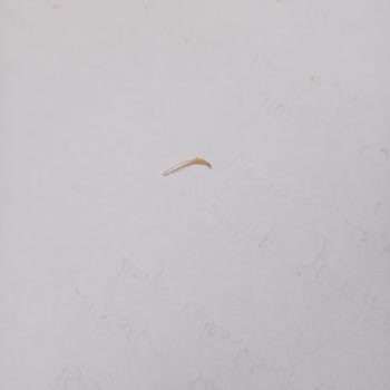 Cipsin İçinden Çıkan Şok Edici Sürpriz