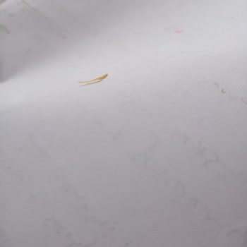 Cipsin İçinden Çıkan Şok Edici Sürpriz