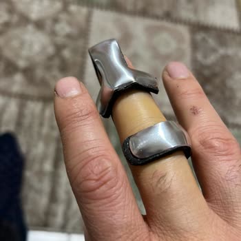 Hastanede İlgisizlik Ve Bekleyiş: Kırık Parmakla Mücadele