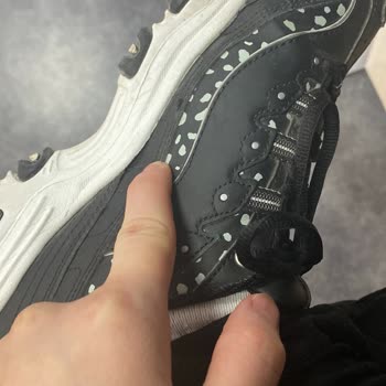 Skechers Ayakkabı Kalitesi Hayal Kırıklığı Yarattı