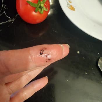 Namet Dönerdeki Belirsiz Yeşil-sarı Madde Ve Yanık Parçalar