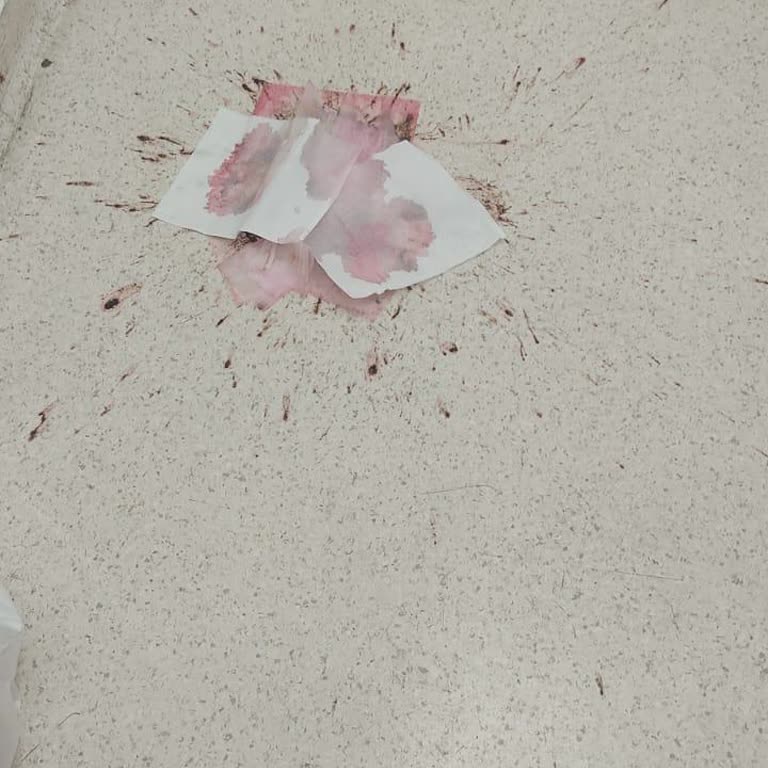 Acil Müdahale Beklerken Temizlik Engeli