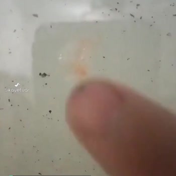 A101 Denta Diş Fırçası Diş Etlerimi Kanattı