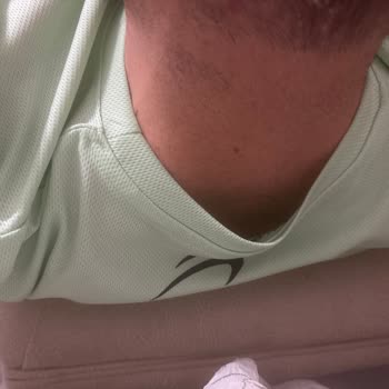 Lazer Epilasyon Sonuçsuz Kaldı