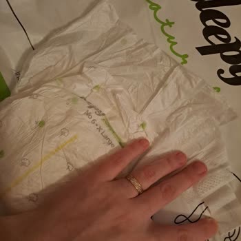 Eksik Cırtlı Bebek Bezleri: Hayal Kırıklığı Ve Maddi Zarar