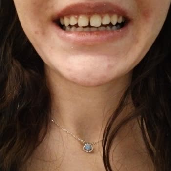 Medipol Diş Hastanesi'nde Hayal Kırıklığı Yaratan Ortodonti Tedavisi