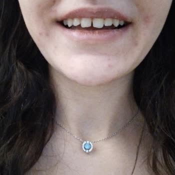 Medipol Diş Hastanesi'nde Hayal Kırıklığı Yaratan Ortodonti Tedavisi