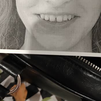 Medipol Diş Hastanesi'nde Hayal Kırıklığı Yaratan Ortodonti Tedavisi