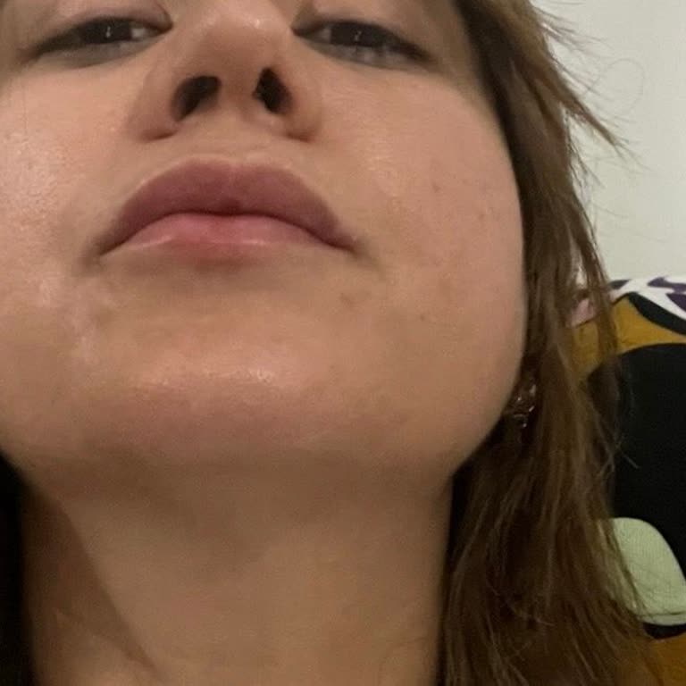 Özel Ekol Hastanesi | İzmir Ameliyat Sonrası Süreçte Hayal Kırıklığı