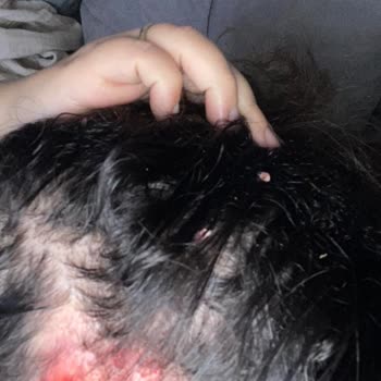 Hair Black (İbrahim Güneş) Kuaförde Yaşanan Kabus: Sağlık Sorunları ve Mağduriyet