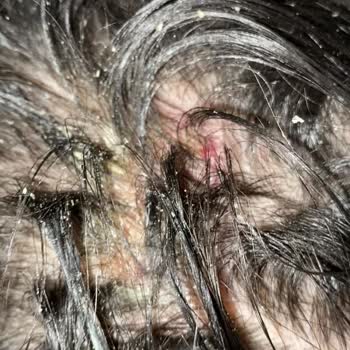 Hair Black (İbrahim Güneş) Kuaförde Yaşanan Kabus: Sağlık Sorunları ve Mağduriyet