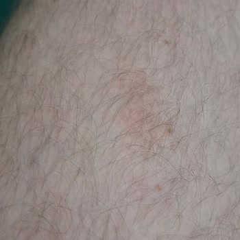 Duru Şampuan Memnuniyetsizliği