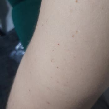 Duru Şampuan Memnuniyetsizliği