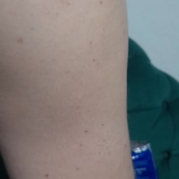 Duru Şampuan Memnuniyetsizliği