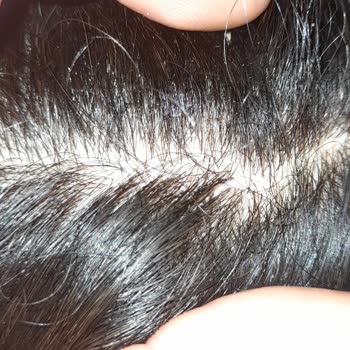 Duru Şampuan Memnuniyetsizliği