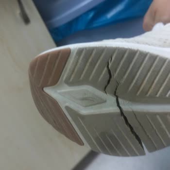 Skechers Ayakkabıda Beklenmedik Taban Sorunu Ve Müşteri Memnuniyetsizliği