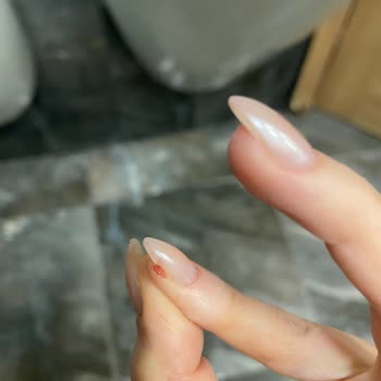 Tırnak Yenileme İşleminde Yaşanan Ağrılı Deneyim Ve Yetersiz Telafi