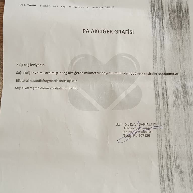 Yanlış Tarihli Akciğer Filmi Ve Yüksek Ücret Şikayeti