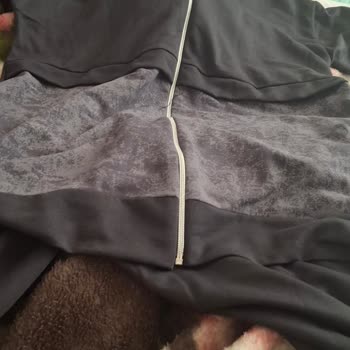 Yanlış Ürün, Hakaret Ve Tehdit: Ameliyatlı Müşteriye Çifte Mağduriyet