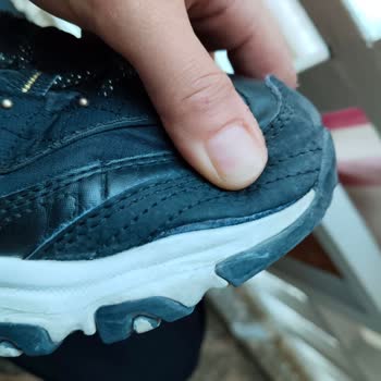 4500 TL'lik Ayakkabı Hayal Kırıklığı: Skechers Garanti Süreci Ve Müşteri Memnuniyetsizliği