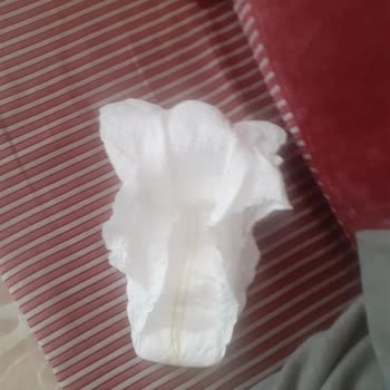 Kalitesiz Canped Hasta Bezi Mağduriyeti