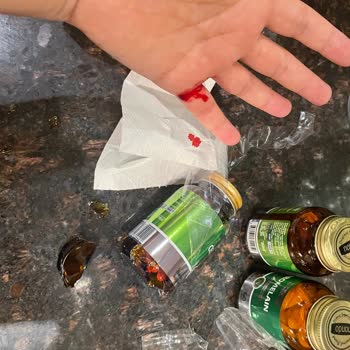 Özensiz Paketleme Nedeniyle Kırık Şişe Ve Yaralanma