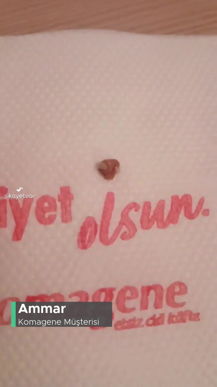 Komagene Çiğköfte İçinden Diş Çıktı! videonun kapak resmi