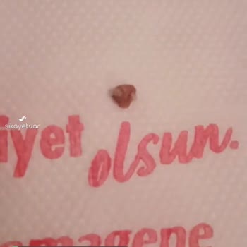 Komagene Çiğköfte İçinden Diş Çıktı!