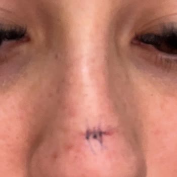 Cansu Erdem Beauty Center Sağlıkla Oynayan Dolgu Deneyimi