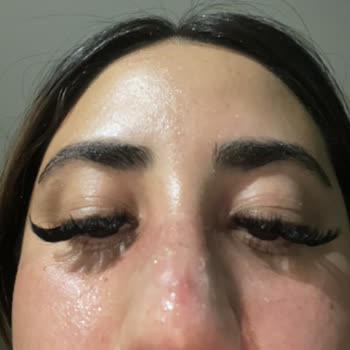 Cansu Erdem Beauty Center Sağlıkla Oynayan Dolgu Deneyimi