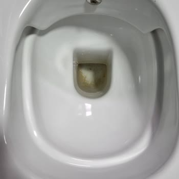 Creavit Klozetin Temizlenemeyen Kararmaları Mağduriyet Yaratıyor