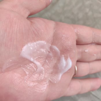 Bozuk Bebek Losyonu Ve İade Sorunu